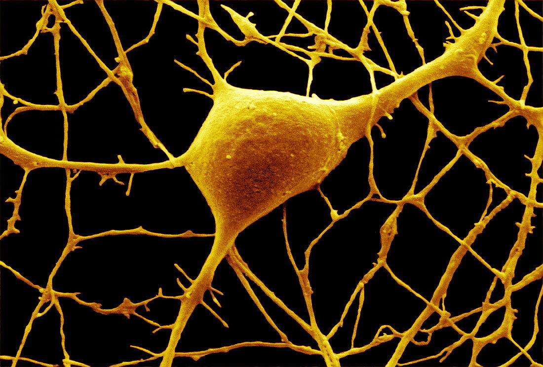 Purkinje nerve cell,SEM