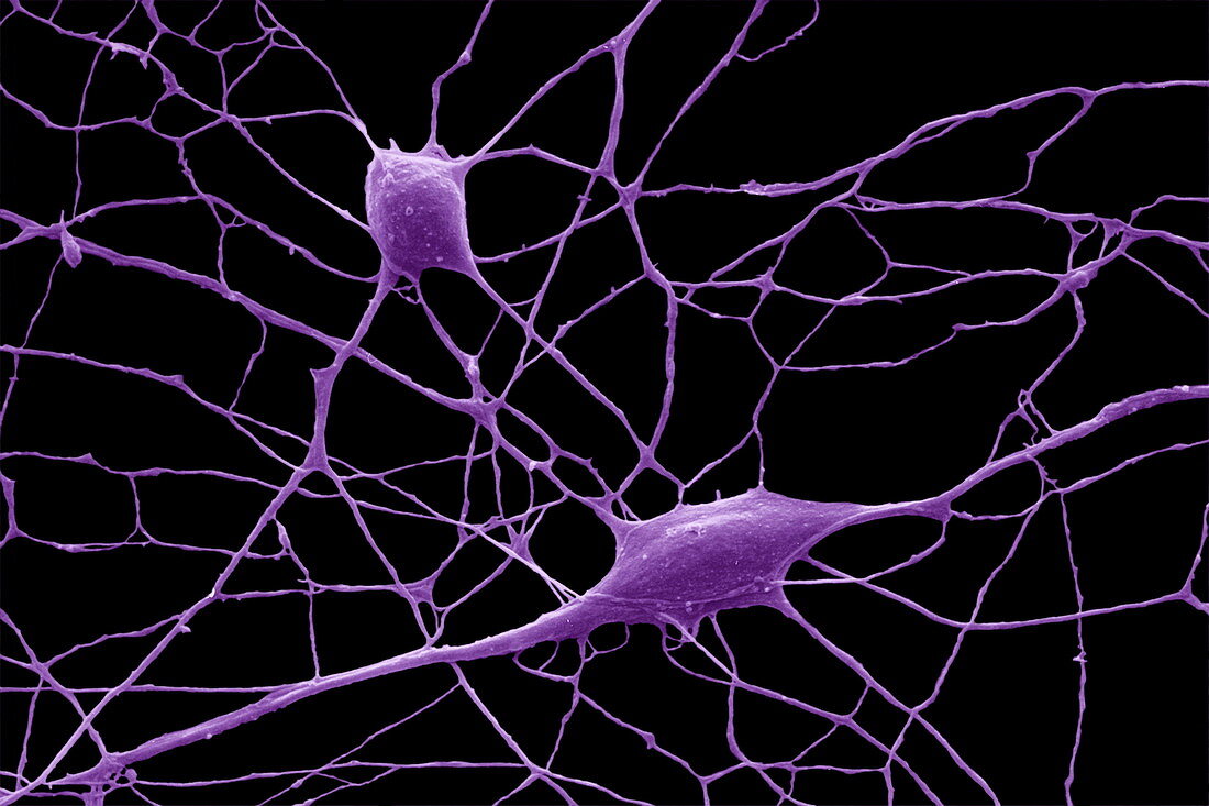 Purkinje nerve cells,SEM