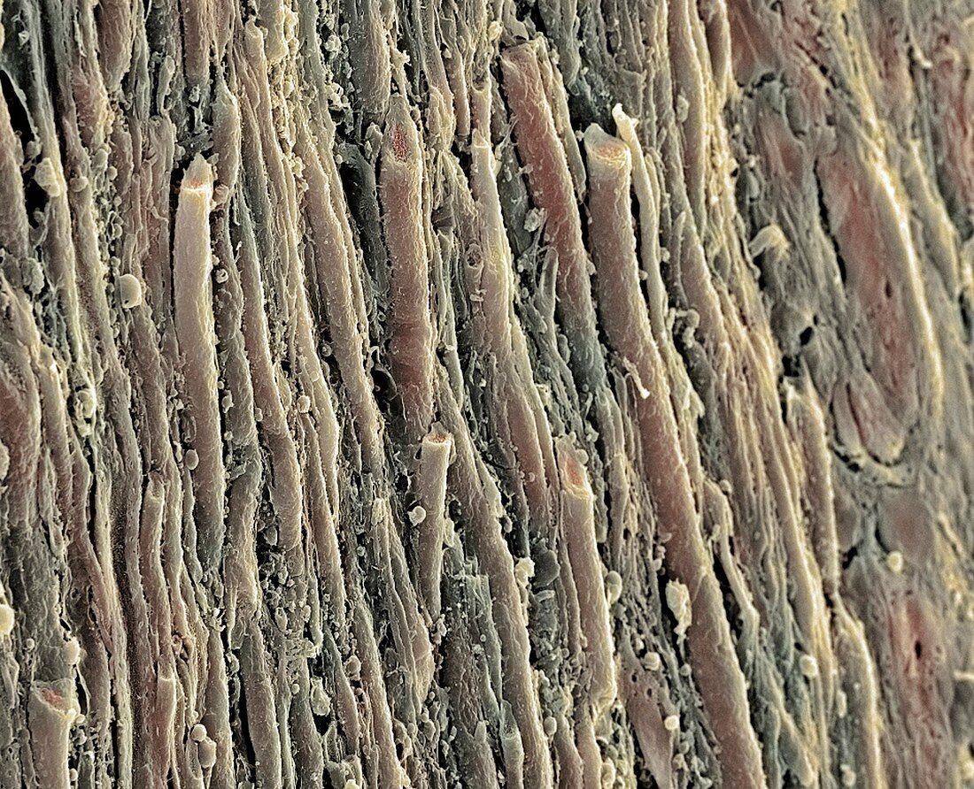 Spinal cord,SEM