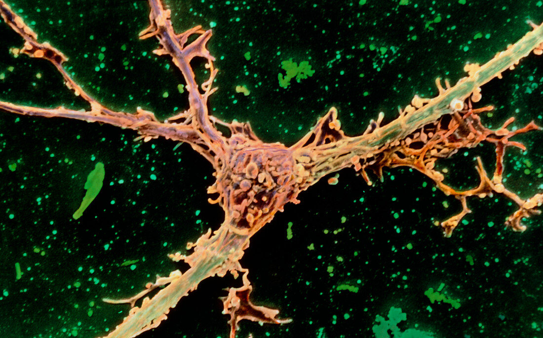 Colour SEM of oligodendrocyte attached to a nerve
