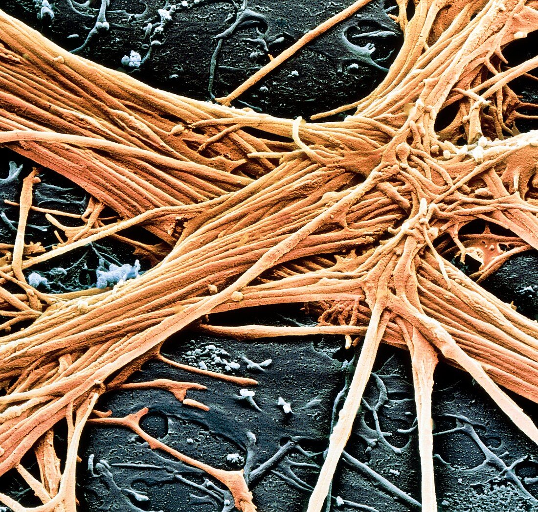 SEM of nerve fibres