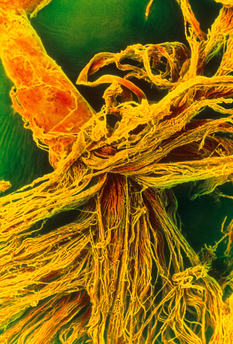 Coloured SEM of nerve fibres and their perineurium