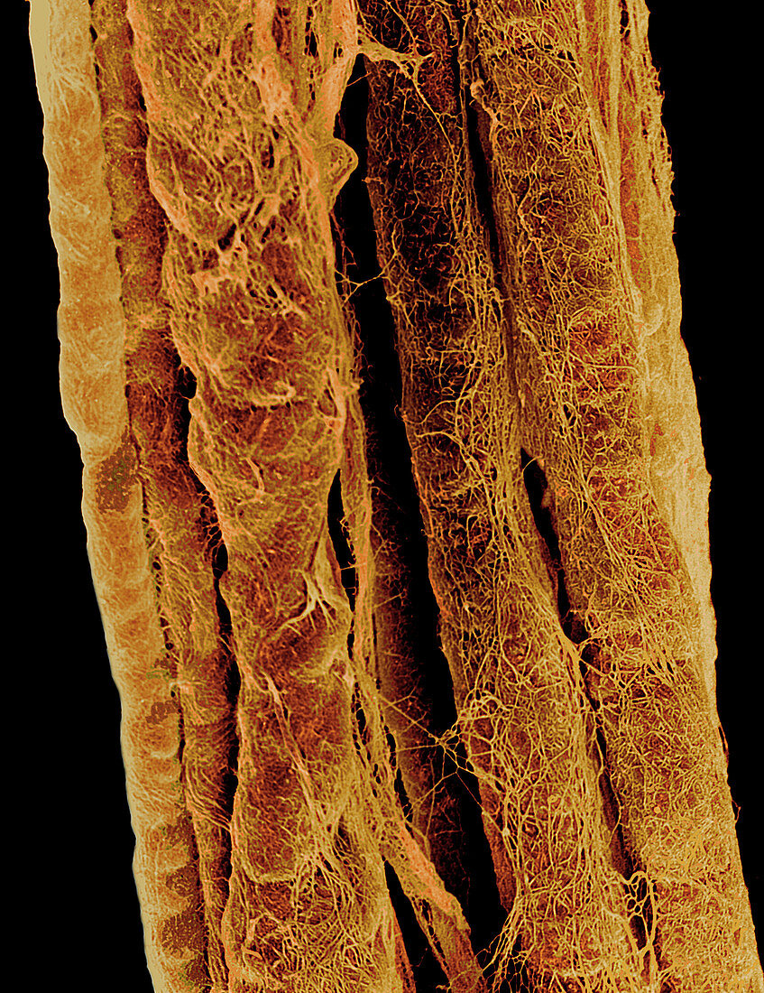 Coloured SEM of some nerve fibres
