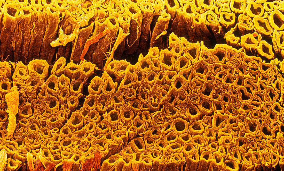 Coloured SEM of some nerve fibres