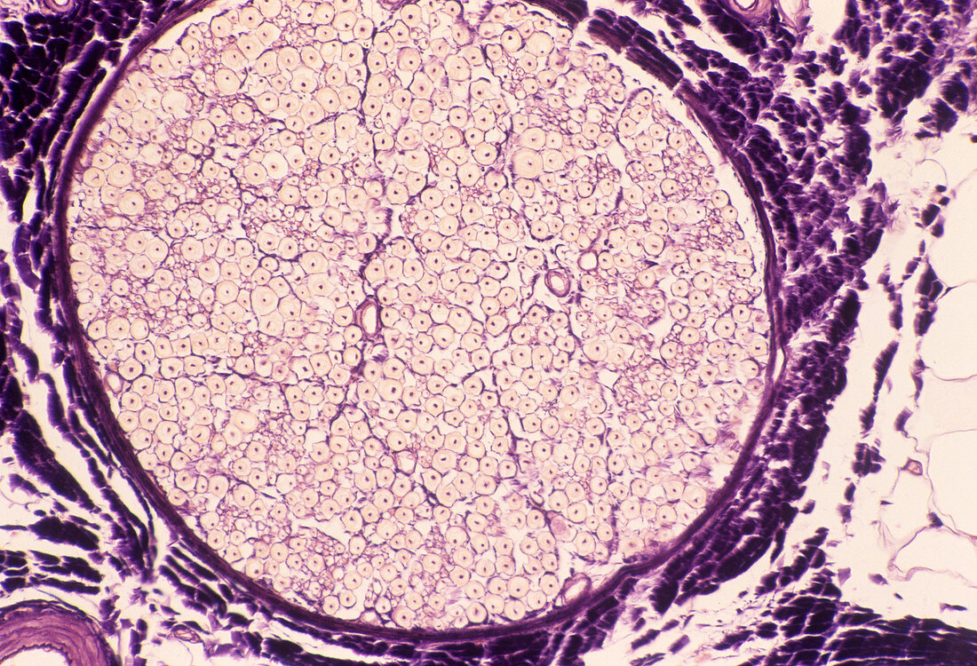 Nerve fibres,light micrograph