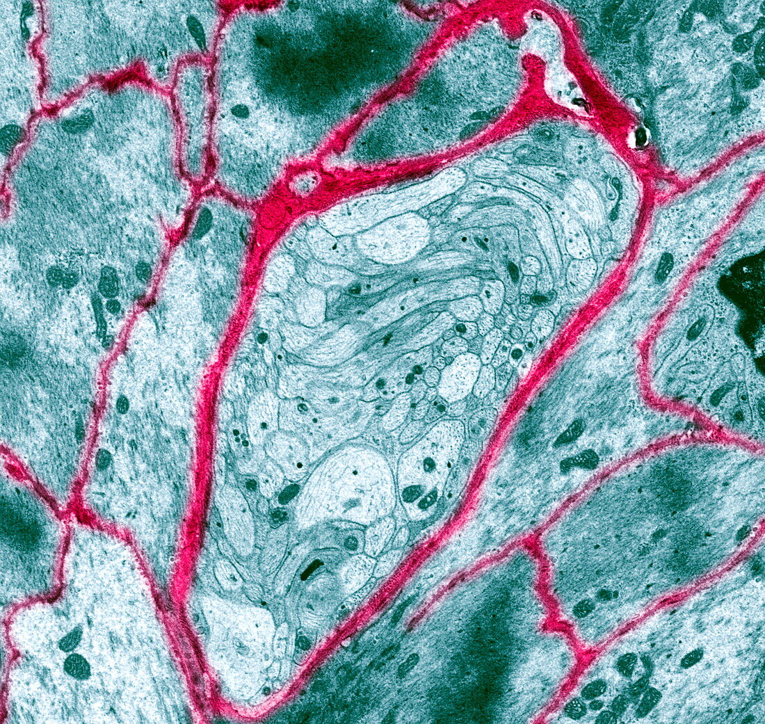Unmyelinated intestinal nerve fibre,TEM