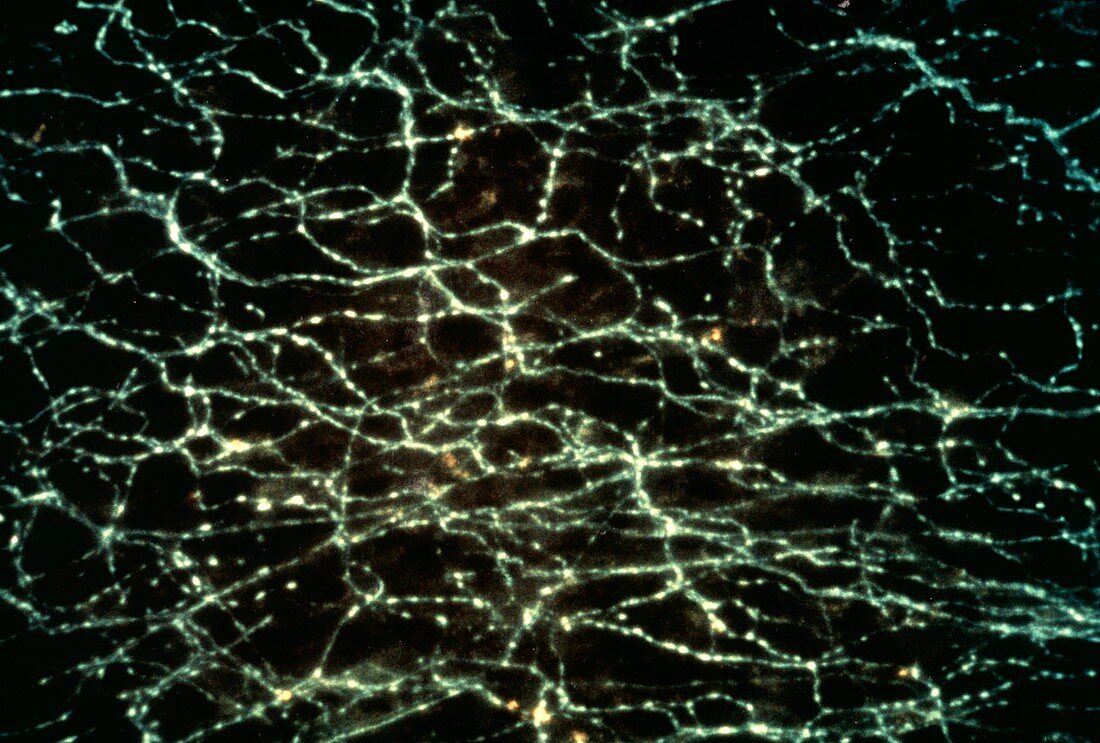 Fluorescence micrograph of nerve fibres