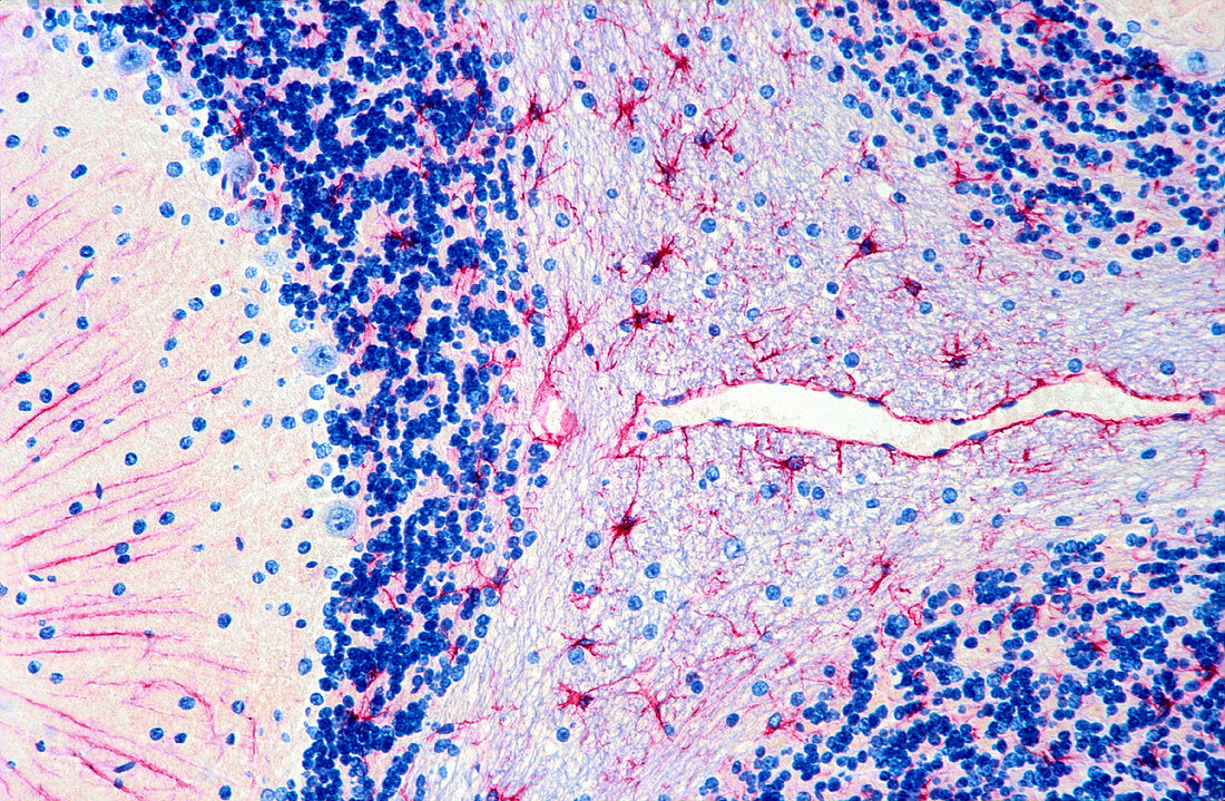 Brain tissue,light micrograph