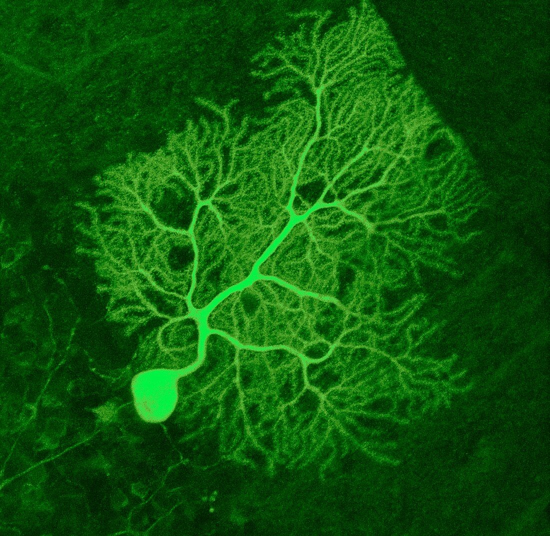 Purkinje nerve cell,light micrograph