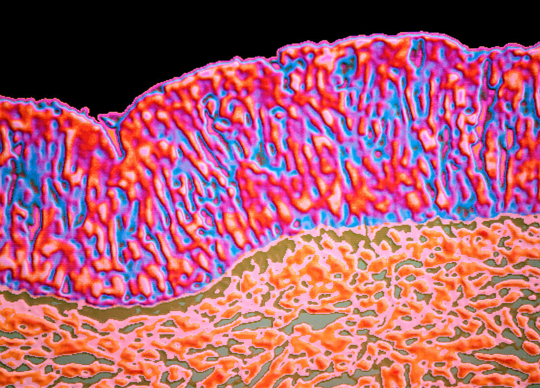 Colour LM of section through human nose epithelium