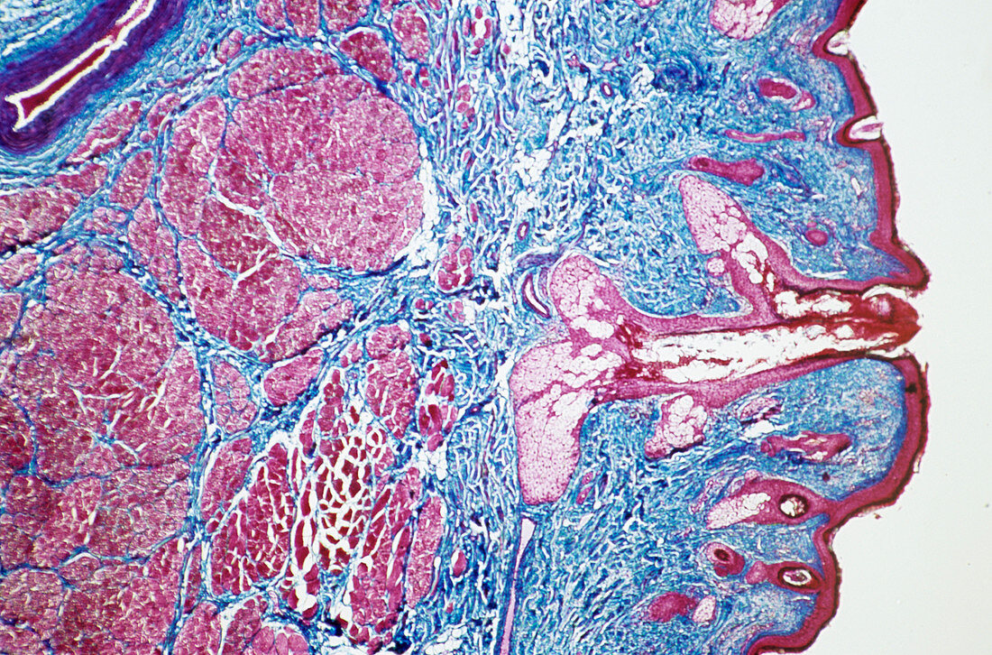 Nose mucosa,light micrograph