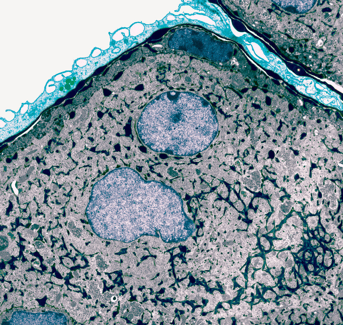 Nasal epithelial cells,TEM