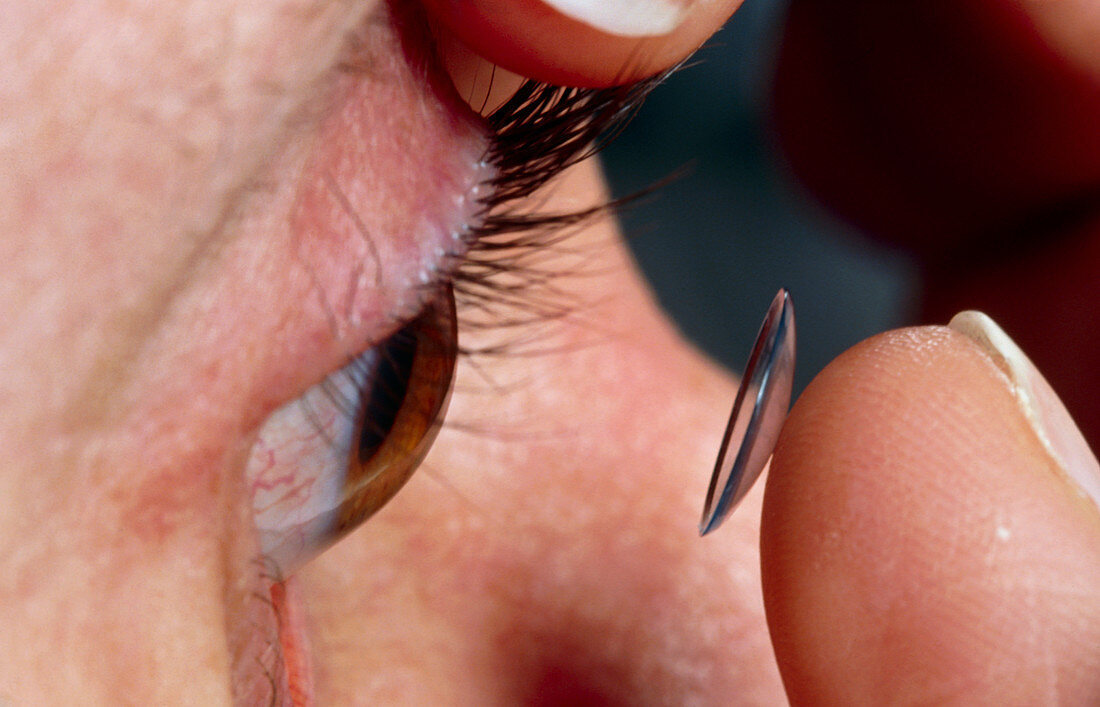 Close-up of hard contact lens being placed in eye