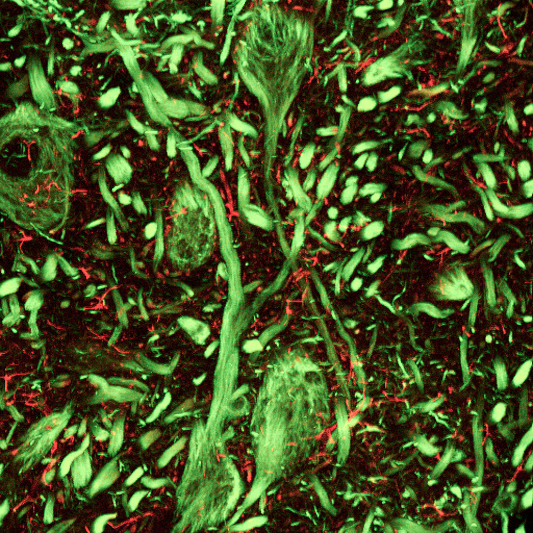 Brainstem nerve cells,light micrograph