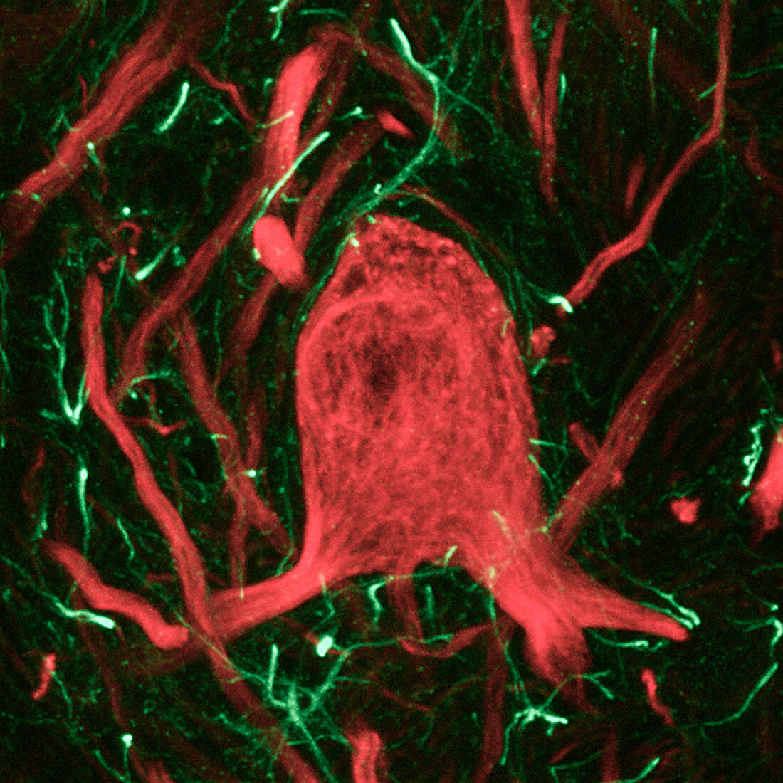 Neuron,confocal light micrograph