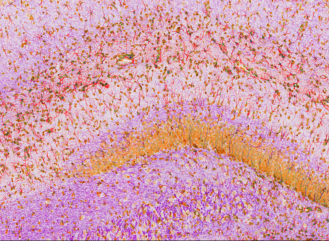 Hippocampus brain tissue