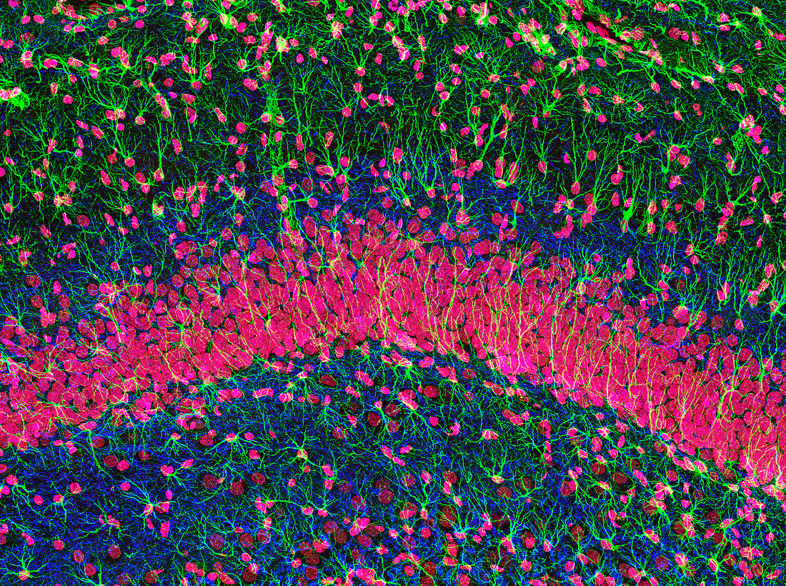 Hippocampus brain tissue