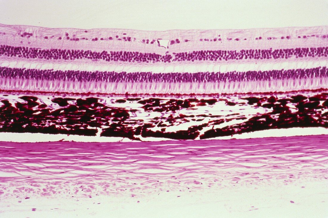 Light micrograph of a section through the eye wall