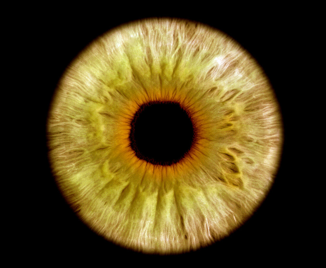 Computer-enhanced green/grey iris of the eye