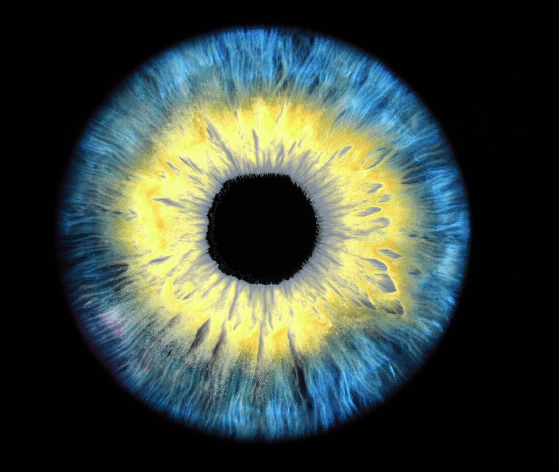 Computer-enhanced blue/yellow iris of the eye