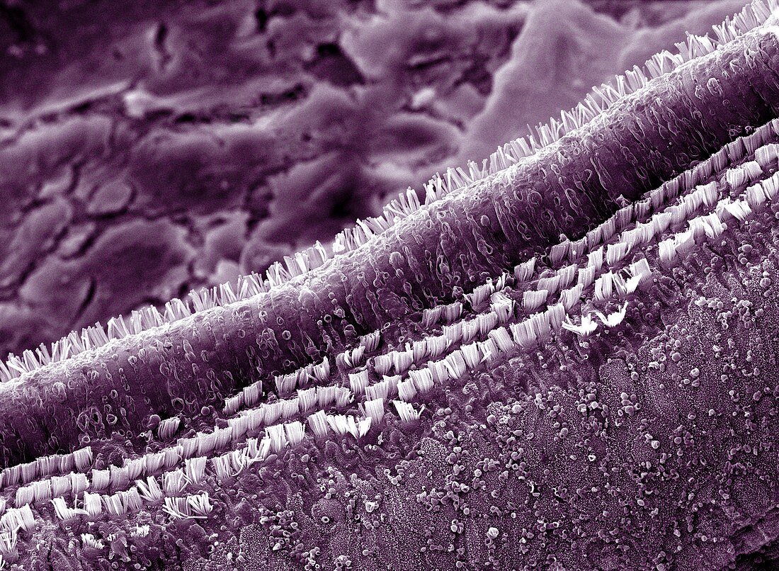 Cochlea cells,SEM