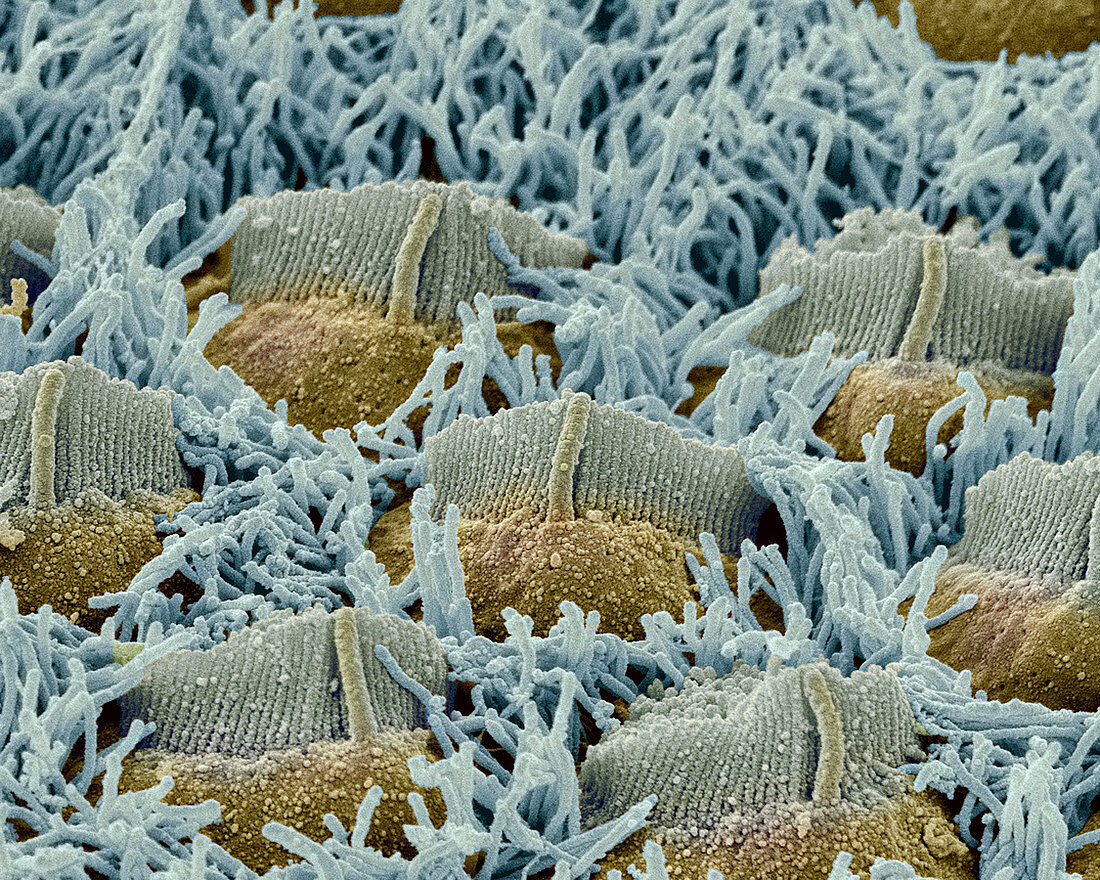Foetal inner ear hair cells,SEM