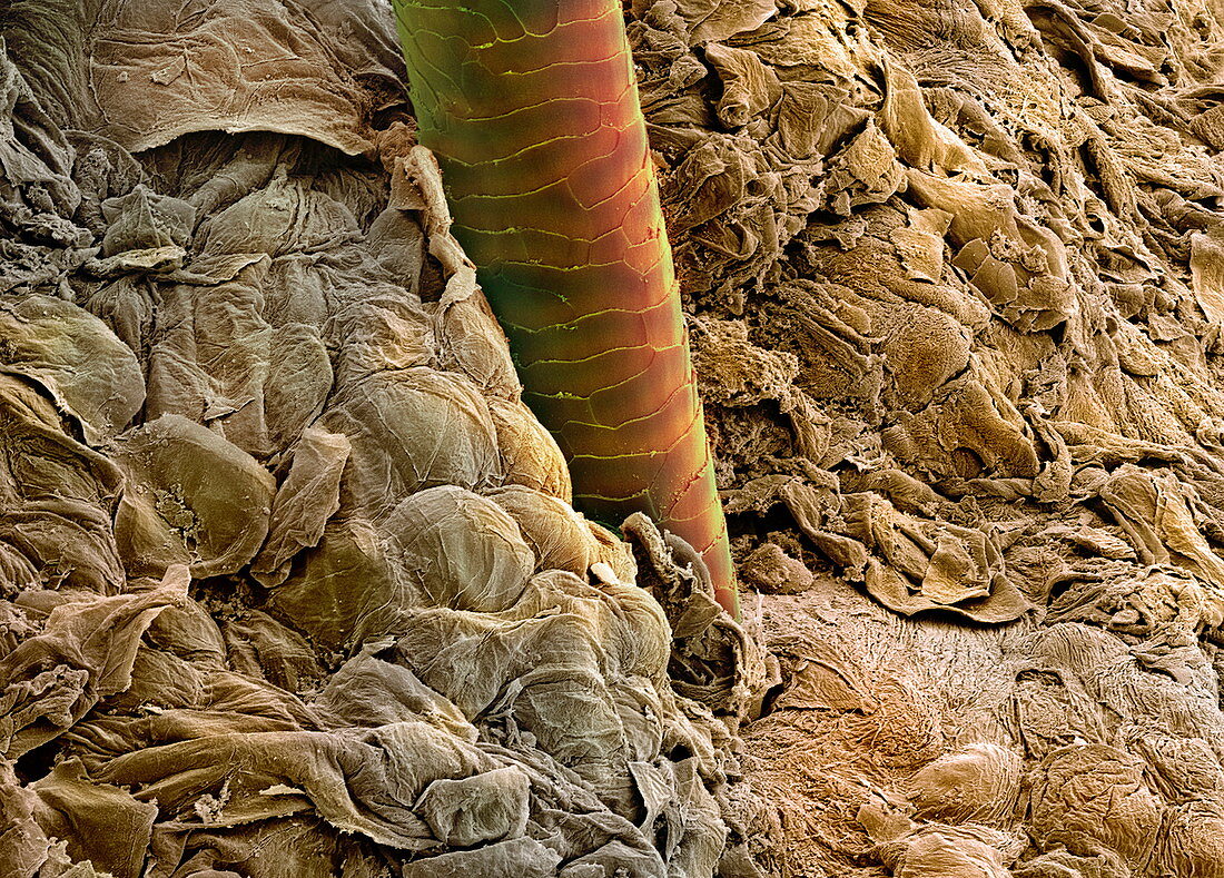 Ear canal,SEM