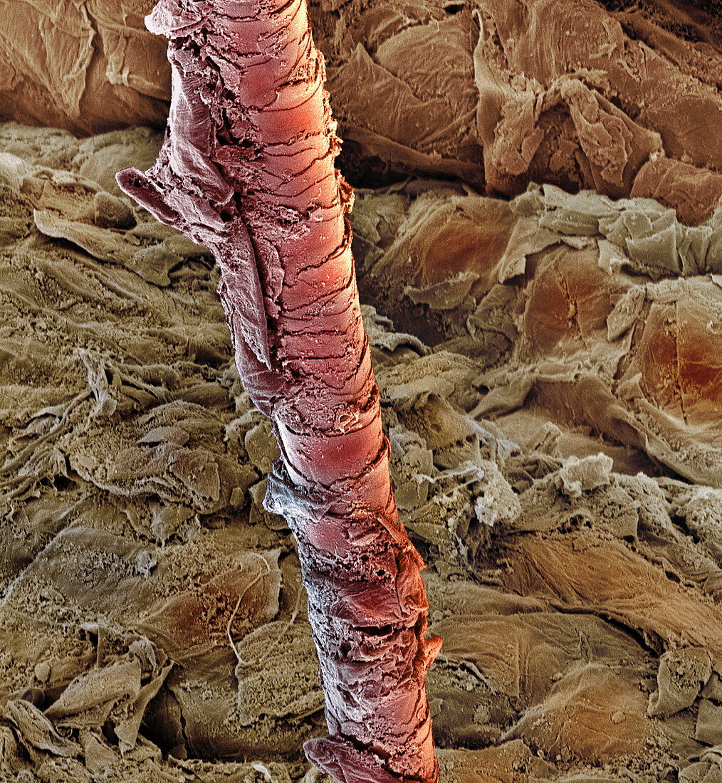 Ear canal,SEM