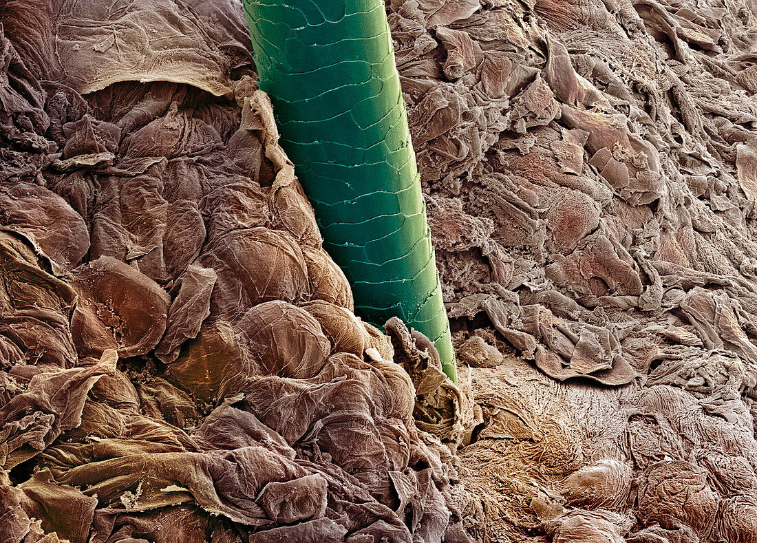 Ear canal,SEM