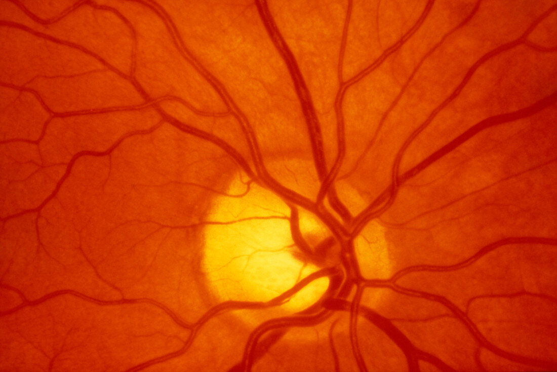 Healthy retina of eye