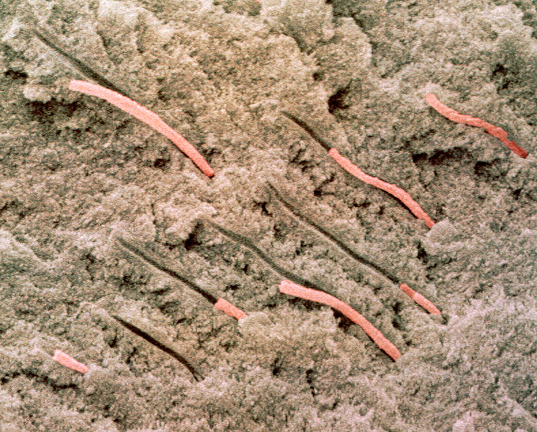 Coloured SEM of dentine with protoplasmic fibres