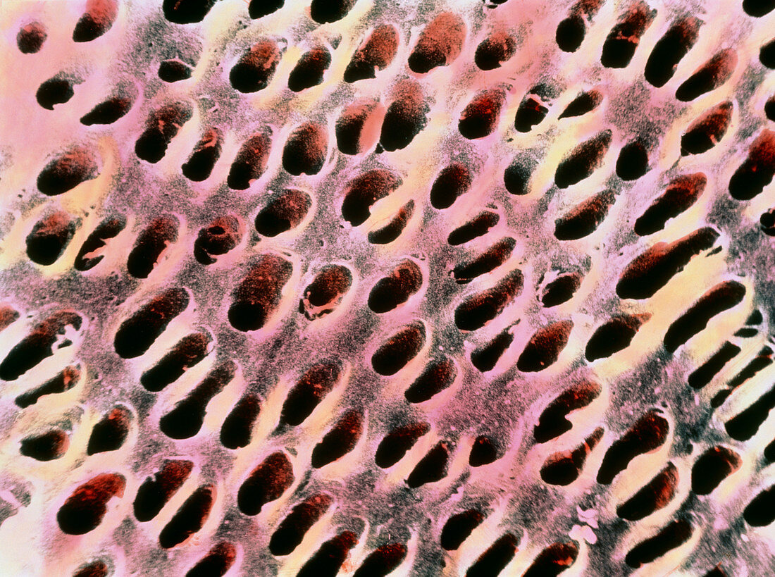 Scanning electron micrograph of dentine on tooth