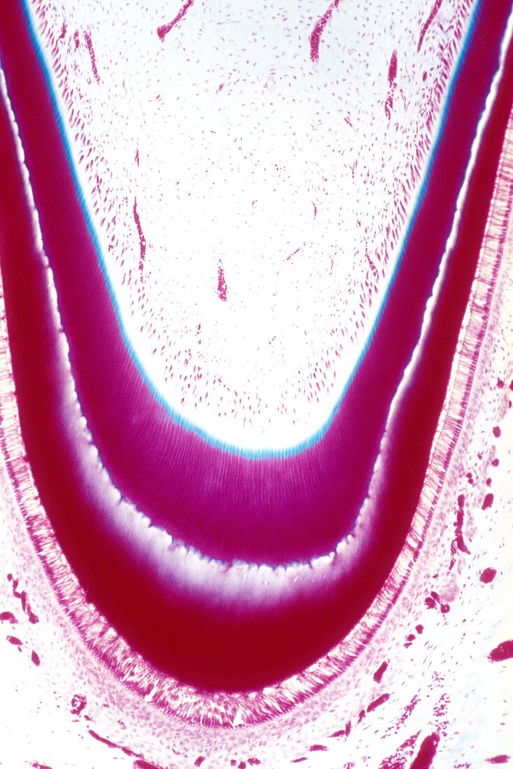 Unerupted foetal tooth,light micrograph