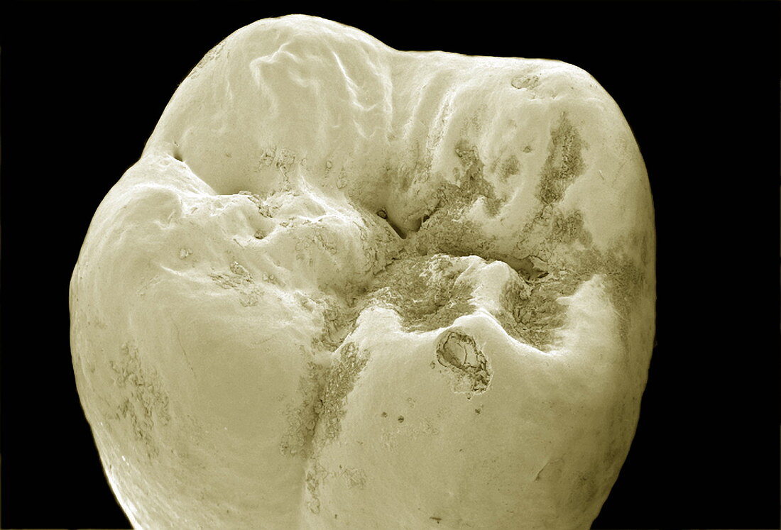 Molar tooth,SEM