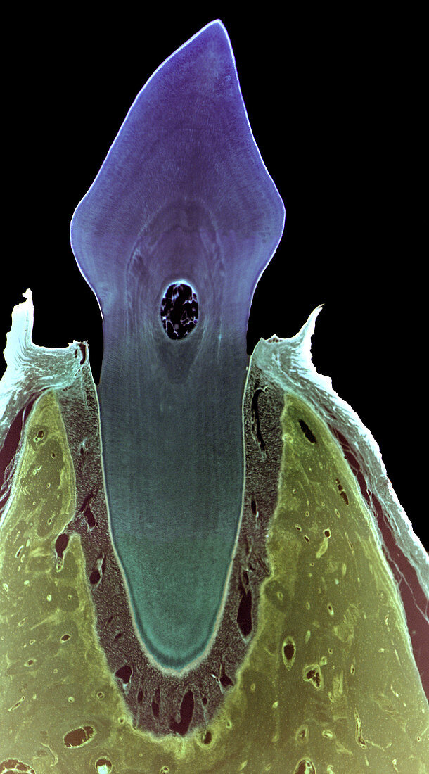 Incisor tooth,light micrograph