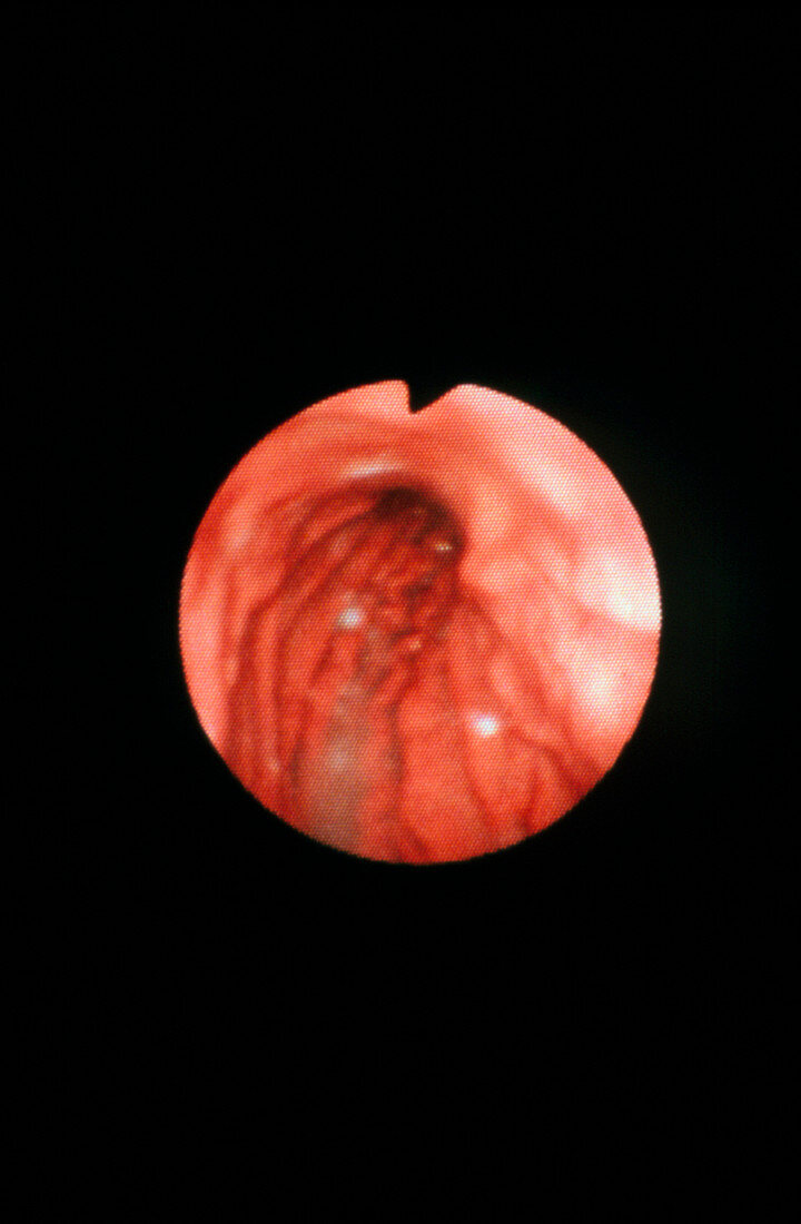 Endoscope image of normal fundus of stomach