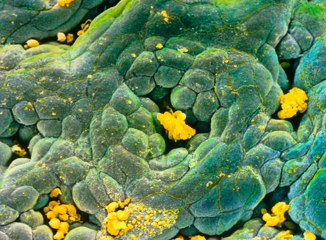 False-colour SEM of gastric gland in stomach