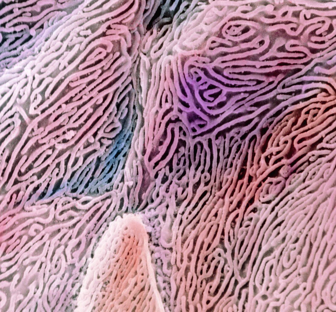 False-colour SEM of epithelium in the oesophagus