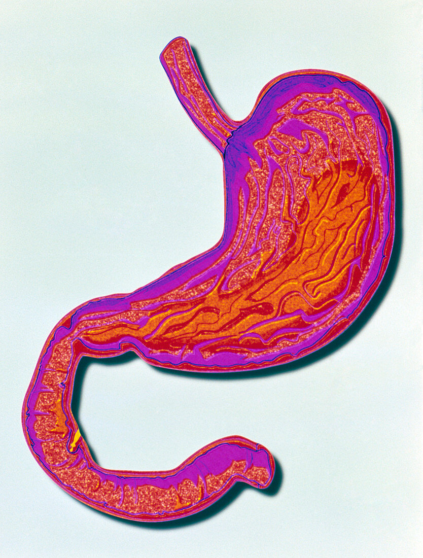 Computer artwork of human stomach