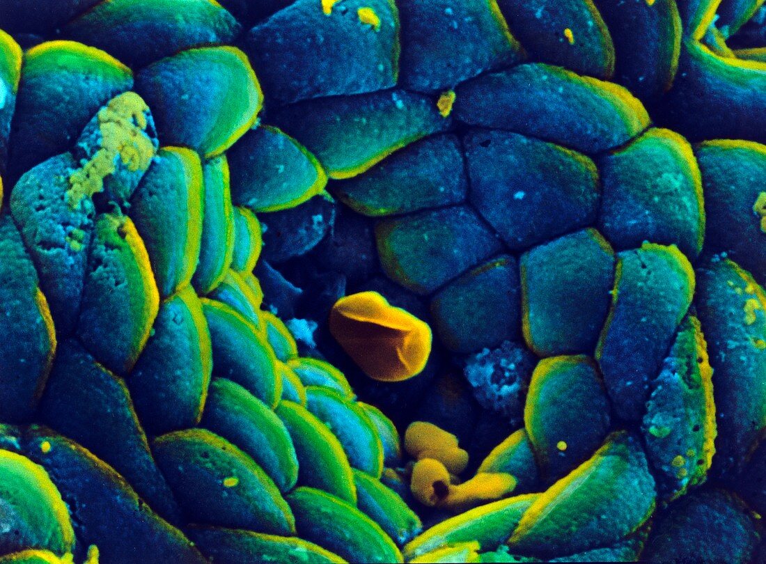 Coloured SEM of the stomach mucosa & gastric pit