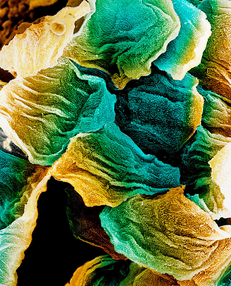 Coloured SEM of epithelial cells in the oesophagus