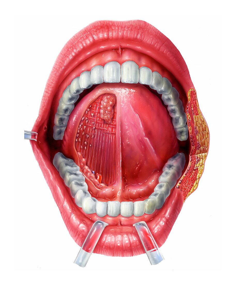 Underside of the tongue