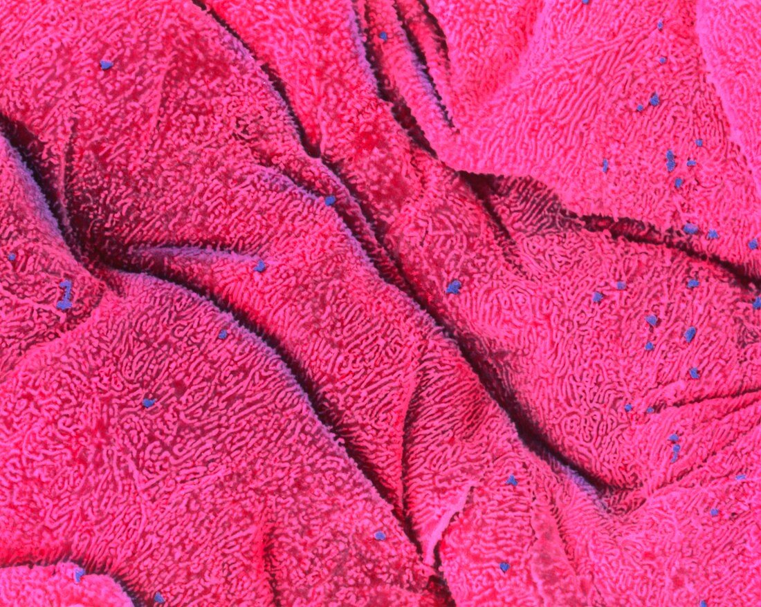 Coloured SEM of the surface of the tongue