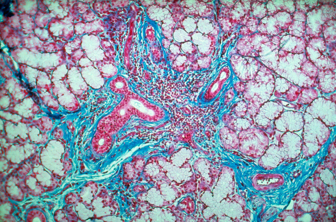 LM of a section of human sublingual gland