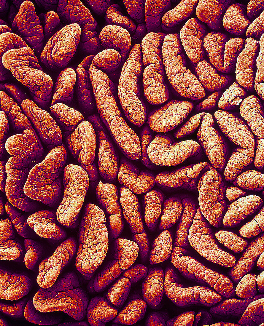 Small intestine villi,SEM