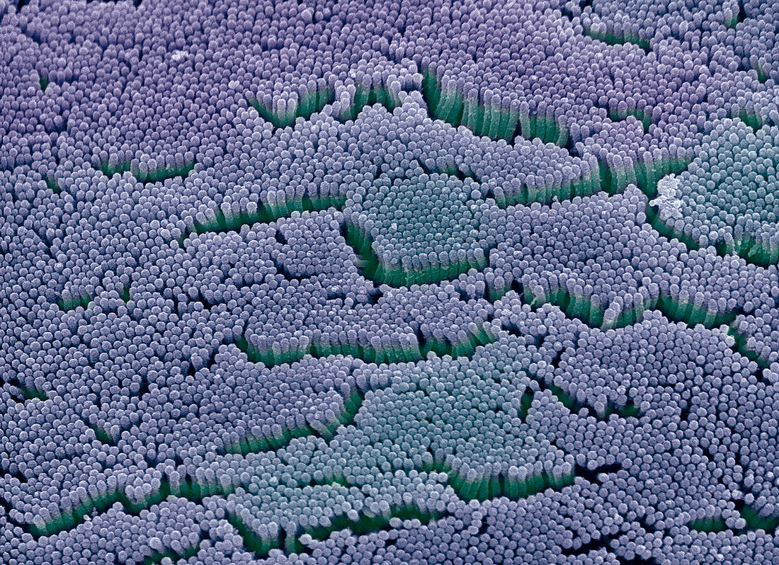 Intestinal microvilli,SEM