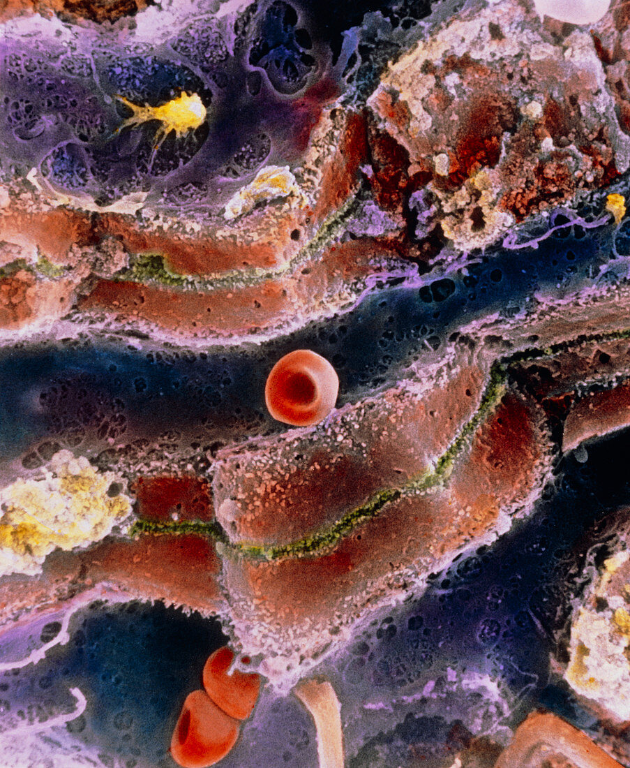 F. colour SEM of blood vessels inside the liver