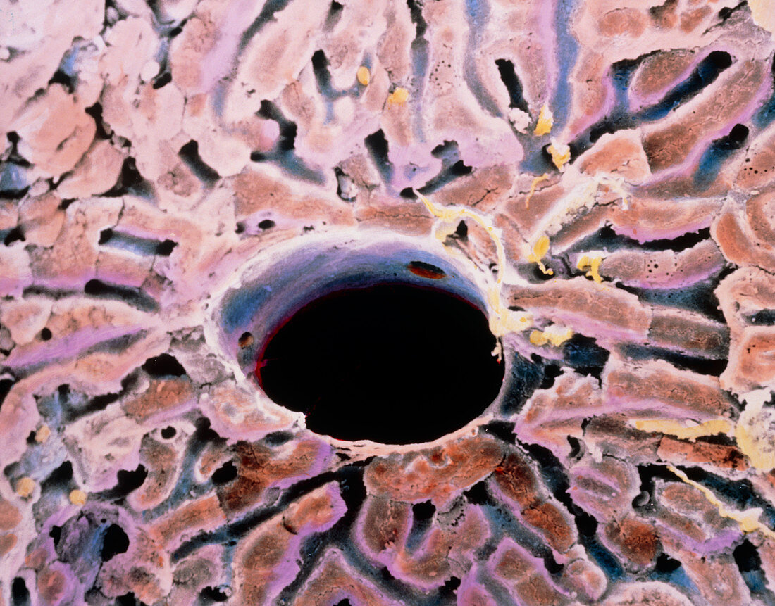 False-colour SEM of a lobule of the liver