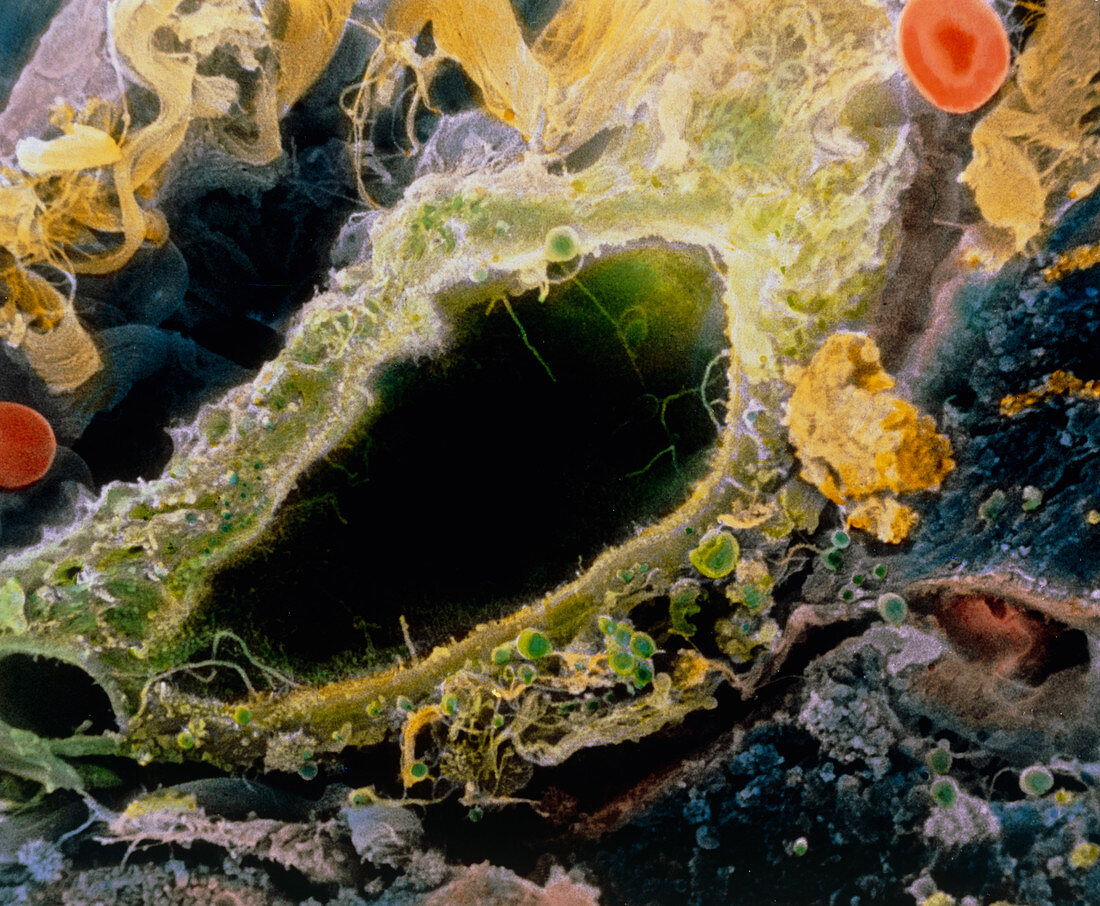 False-colour SEM of a bile duct within the liver