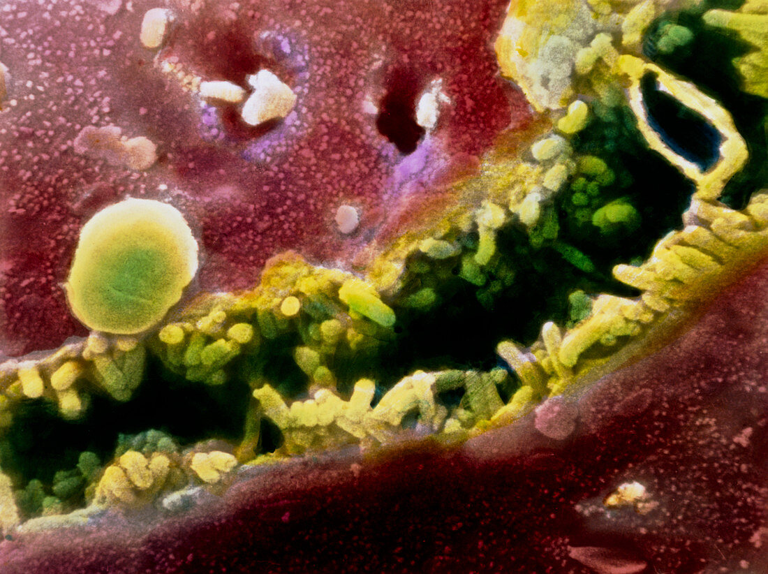Coloured SEM of a bile canaliculus in the liver